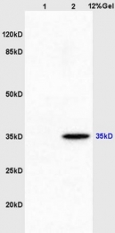 bs-2509R - JTV1 / AIMP2