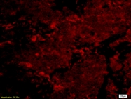 bs-2513R - NFKBIA / IKBA