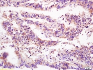 bs-2567R - CD148 / PTPRJ