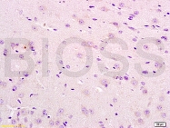 bs-2604R - IL12RB2