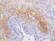bs-2604R - IL12RB2