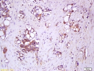bs-2607R - IL17RC