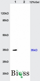 bs-2610R - IL17RB / IL17BR