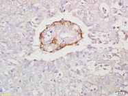 bs-2611R - Interleukin-17C / IL17C