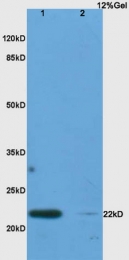 bs-2611R - Interleukin-17C / IL17C