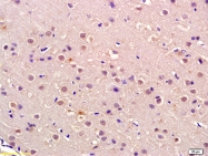 bs-2777R - Retinoblastoma-associated protein / RB1
