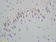 bs-2794R - RGS5