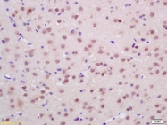 bs-2800R - Endonuclease G