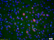 bs-2800R - Endonuclease G