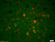 bs-2800R - Endonuclease G