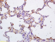 bs-2808R - Tyrosine-protein kinase JAK3