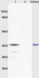 bs-2939R - RASSF2