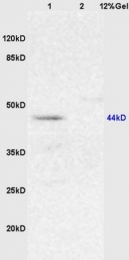 bs-2967R - Maltose Binding Protein Tag / MBP-Tag