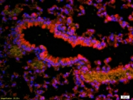 bs-2987R - Vitamin D3 receptor / NR1I1