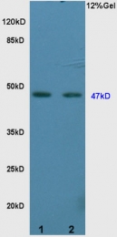 bs-2987R - Vitamin D3 receptor / NR1I1