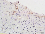 bs-2987R - Vitamin D3 receptor / NR1I1