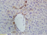 bs-2987R - Vitamin D3 receptor / NR1I1