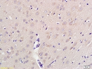 bs-3002R - Beta-2 adrenergic receptor
