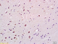 bs-3012R - Bcl-2-like 11