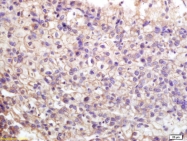 bs-3035R - ATP1A1