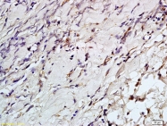 bs-3050R - Aurora kinase A