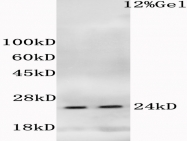 bs-3171R - Histone H1.4