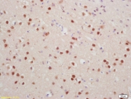 bs-3171R - Histone H1.4