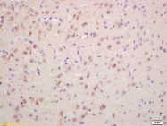 bs-3186R - Histone H3.1t
