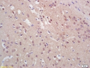 bs-3187R - Histone H3.1t