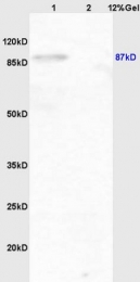 bs-3232R - IKBKB / IKKB