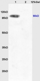 bs-3456R - TrkA + TrkB