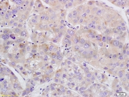 bs-3474R - WEE1 / Wee1-like protein kinase