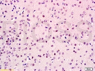 bs-3515R - ID2 / BHLHB26