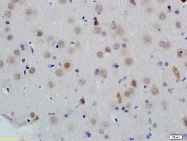 bs-3529R - ID1 / BHLHB24