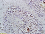 bs-3529R - ID1 / BHLHB24