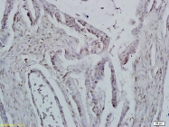 bs-3529R - ID1 / BHLHB24