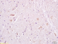 bs-3586R - Tuberin / TSC2