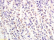 bs-3586R - Tuberin / TSC2