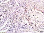 bs-3586R - Tuberin / TSC2