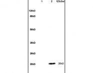 bs-3615R - ESM1