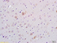 bs-3712R - Delta-type opioid receptor