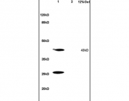 bs-3856R - 17-beta-HSD2 / HSD17B2