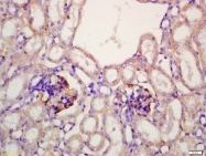 bs-3909R - LRP2