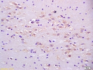 bs-3946R - Isocitric dehydrogenase alpha / IDH3A