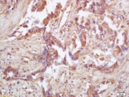 bs-3947R - Isocitrate dehydrogenase / IDH2
