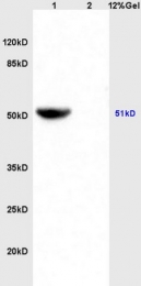 bs-3947R - Isocitrate dehydrogenase / IDH2