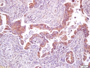 bs-3967R - AMPK beta-2 chain / PRKAB2