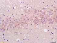 bs-3979R - Enolase beta