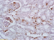 bs-3994R - Hexokinase-3