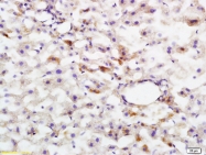 bs-4063R - HMG-CoA reductase / HMGCR